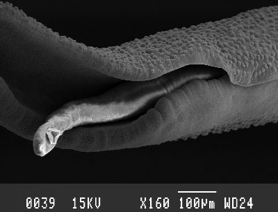 Schistosoma mansoni hannen omfavner hunnen for at beskytte hende